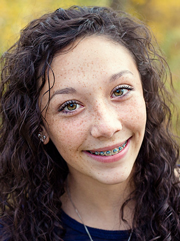Understanding the Cost of Braces and Orthodontic Treatment